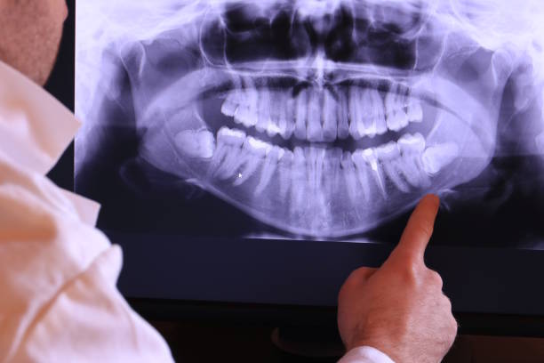 Best Cosmetic Emergency Dentistry in Fircrest, WA