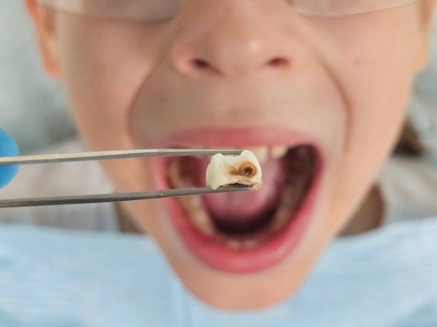 Best Weekend Emergency Dentist in Fircrest, WA